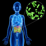 How Gut Health Drives Inflammation—and What You Can Do to Take Control